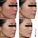 Mela W Corrector 20ml thumbnail 4